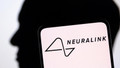 Elon Musk'ın şirketi Neuralink, insanlı deneme için onay aldı!