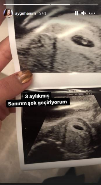 Aygün Aydın'dan şok hamilelik paylaşımı! Sosyal medya sallandı - Sayfa 3