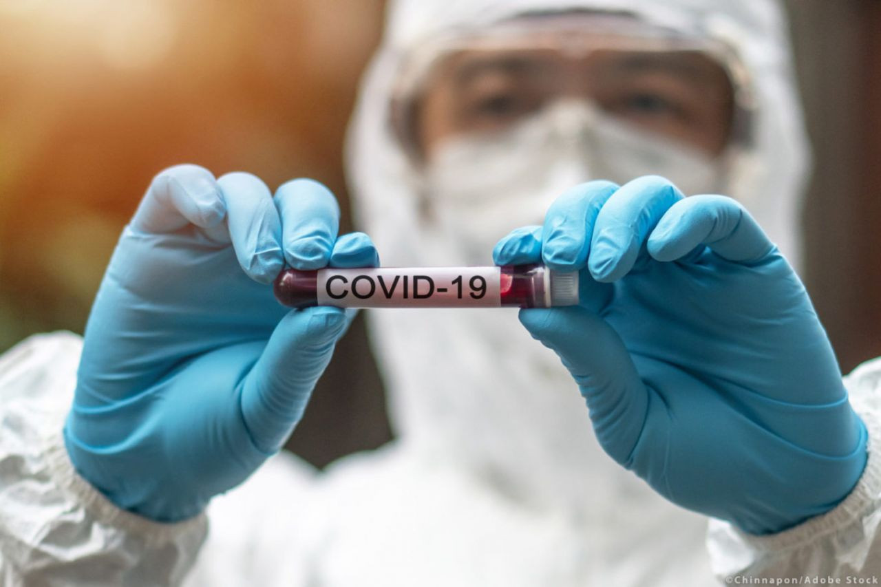 Otopsi incelemelerinde ortaya çıktı! İşte koronavirüsün hiç bilinmeyen büyük riski - Resim : 4