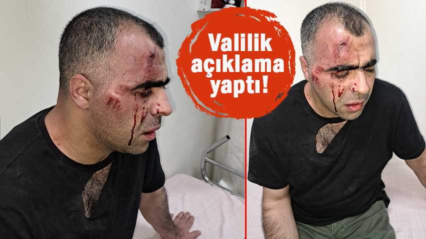 Gazeteci Sinan Aygül'e saldırı! 